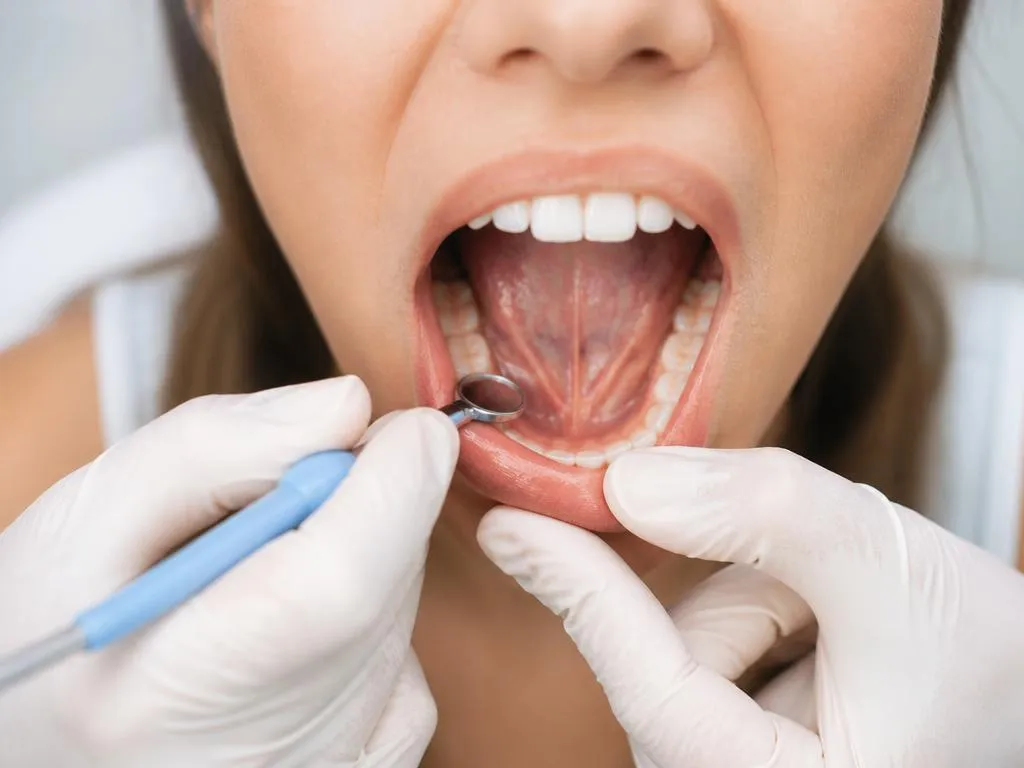 Claves para mantener la higiene y salud del suelo de la boca